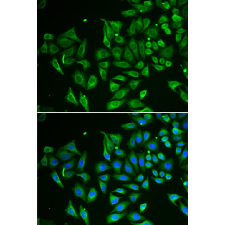 Immunofluorescence - CLEC3B antibody from Signalway Antibody (38897) - Antibodies.com