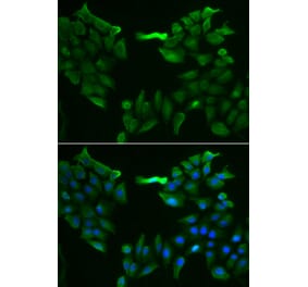 Immunofluorescence - SLC5A6 antibody from Signalway Antibody (38912) - Antibodies.com