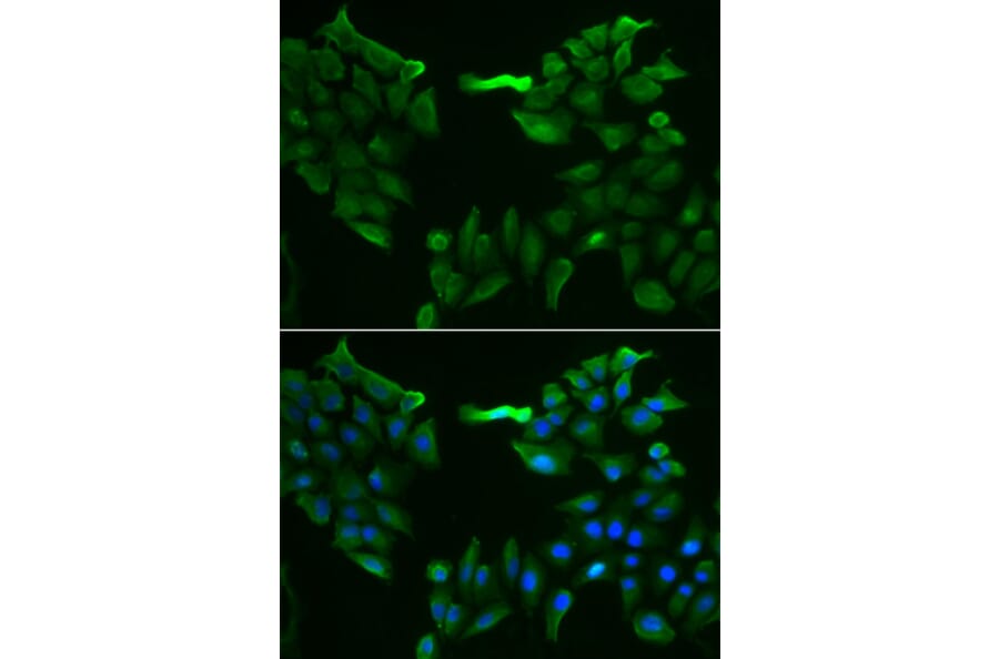Immunofluorescence - SLC5A6 antibody from Signalway Antibody (38912) - Antibodies.com