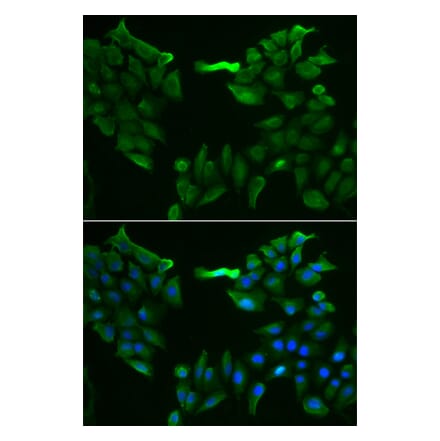 Immunofluorescence - SLC5A6 antibody from Signalway Antibody (38912) - Antibodies.com