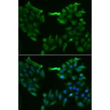 Immunofluorescence - SLC5A6 antibody from Signalway Antibody (38912) - Antibodies.com