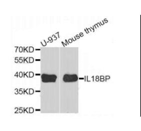 Western blot - IL18BP antibody from Signalway Antibody (38923) - Antibodies.com