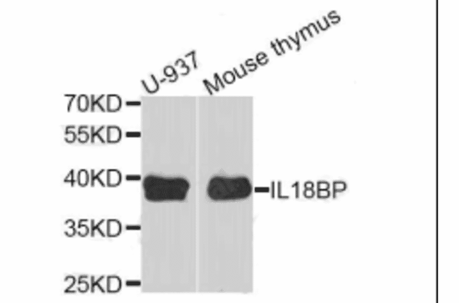 Western blot - IL18BP antibody from Signalway Antibody (38923) - Antibodies.com