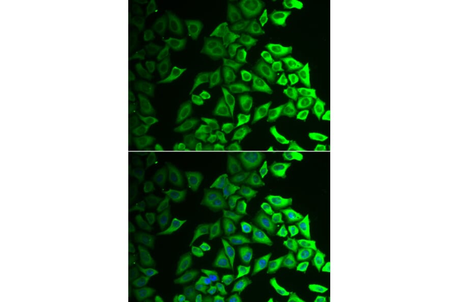 Immunofluorescence - IL18BP antibody from Signalway Antibody (38923) - Antibodies.com