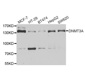 Western blot - DNMT3A antibody from Signalway Antibody (38966) - Antibodies.com