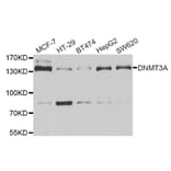 Western blot - DNMT3A antibody from Signalway Antibody (38966) - Antibodies.com