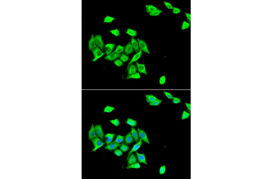 Immunofluorescence - DNMT3A antibody from Signalway Antibody (38966) - Antibodies.com