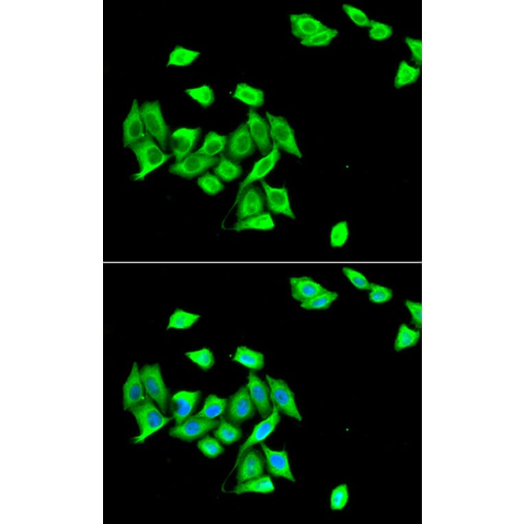 Immunofluorescence - DNMT3A antibody from Signalway Antibody (38966) - Antibodies.com