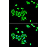 Immunofluorescence - DNMT3A antibody from Signalway Antibody (38966) - Antibodies.com