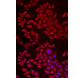 Immunofluorescence - AGPAT2 antibody from Signalway Antibody (38972) - Antibodies.com