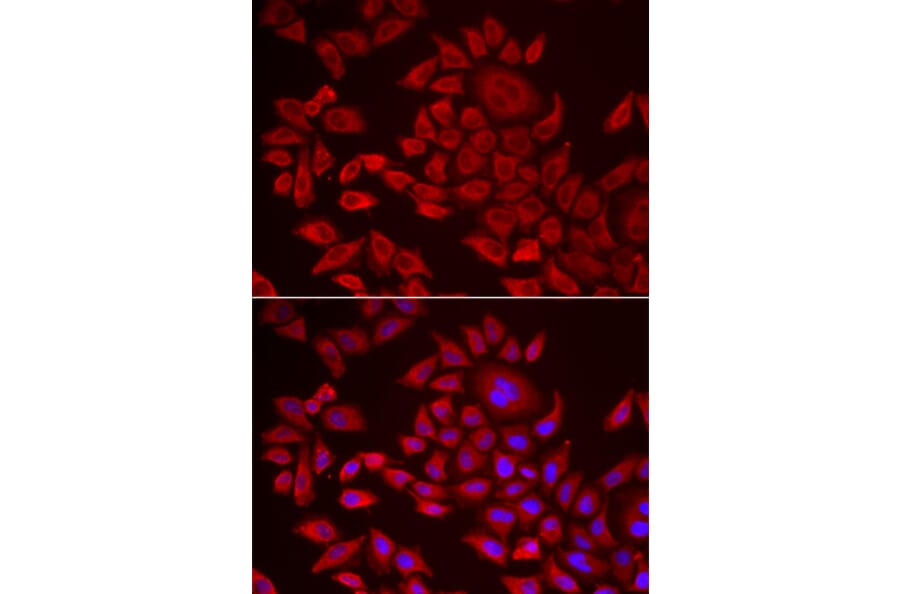 Immunofluorescence - AGPAT2 antibody from Signalway Antibody (38972) - Antibodies.com