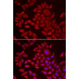 Immunofluorescence - AGPAT2 antibody from Signalway Antibody (38972) - Antibodies.com