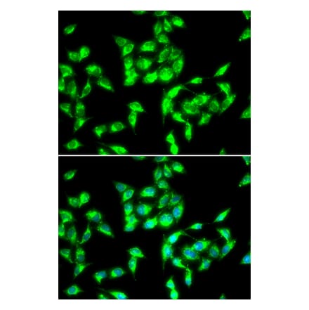 Immunofluorescence - ANTXR1 antibody from Signalway Antibody (38979) - Antibodies.com