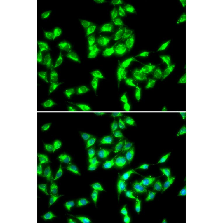 Immunofluorescence - ANTXR1 antibody from Signalway Antibody (38979) - Antibodies.com
