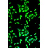 Immunofluorescence - ANTXR1 antibody from Signalway Antibody (38979) - Antibodies.com