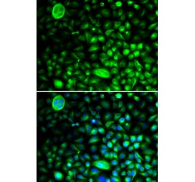 Immunofluorescence - CACNG2 antibody from Signalway Antibody (38990) - Antibodies.com