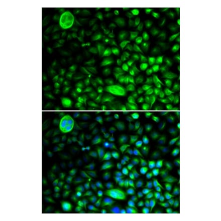 Immunofluorescence - CACNG2 antibody from Signalway Antibody (38990) - Antibodies.com