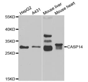 Western blot - CASP14 antibody from Signalway Antibody (38994) - Antibodies.com