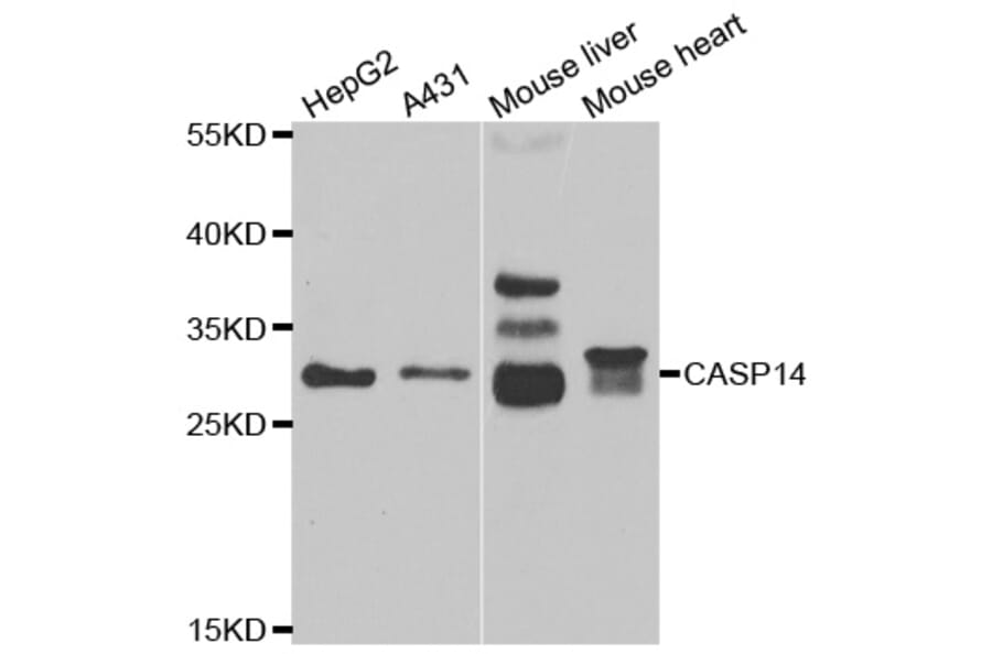 Western blot - CASP14 antibody from Signalway Antibody (38994) - Antibodies.com