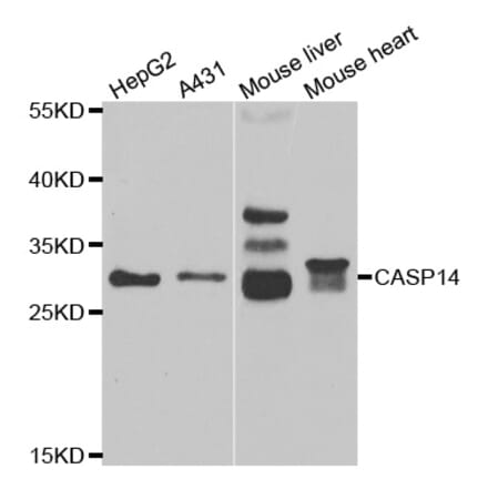 Western blot - CASP14 antibody from Signalway Antibody (38994) - Antibodies.com