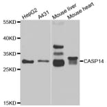 Western blot - CASP14 antibody from Signalway Antibody (38994) - Antibodies.com