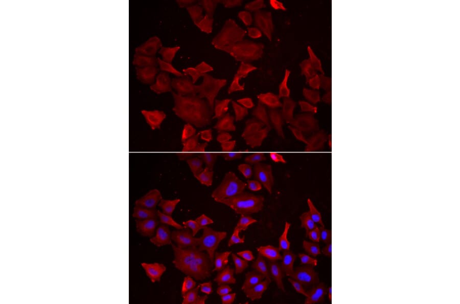 Immunofluorescence - CASP14 antibody from Signalway Antibody (38994) - Antibodies.com
