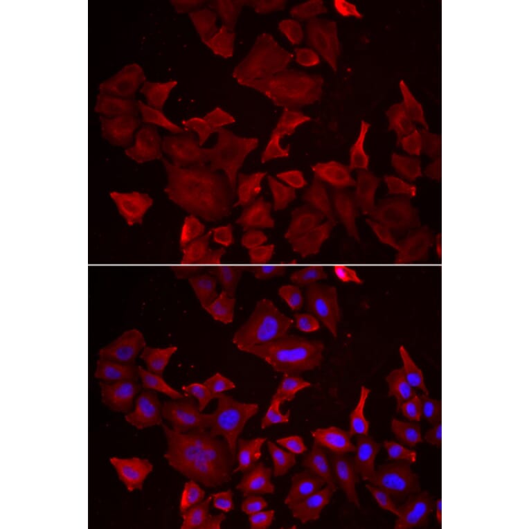 Immunofluorescence - CASP14 antibody from Signalway Antibody (38994) - Antibodies.com