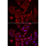 Immunofluorescence - CASP14 antibody from Signalway Antibody (38994) - Antibodies.com