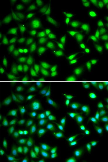 Immunofluorescence analysis of HeLa cell using CDKN2D antibody. Blue: DAPI for nuclear staining.