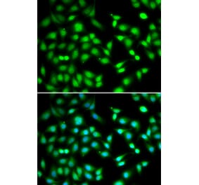 Immunofluorescence - CDKN2D antibody from Signalway Antibody (39004) - Antibodies.com