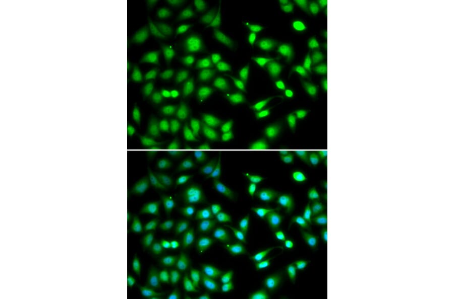 Immunofluorescence - CDKN2D antibody from Signalway Antibody (39004) - Antibodies.com