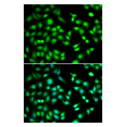 Immunofluorescence - CDKN2D antibody from Signalway Antibody (39004) - Antibodies.com