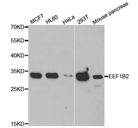 Western blot - EEF1B2 antibody from Signalway Antibody (39022) - Antibodies.com