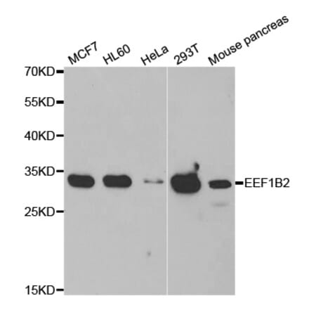Western blot - EEF1B2 antibody from Signalway Antibody (39022) - Antibodies.com