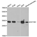 Western blot - EEF1B2 antibody from Signalway Antibody (39022) - Antibodies.com