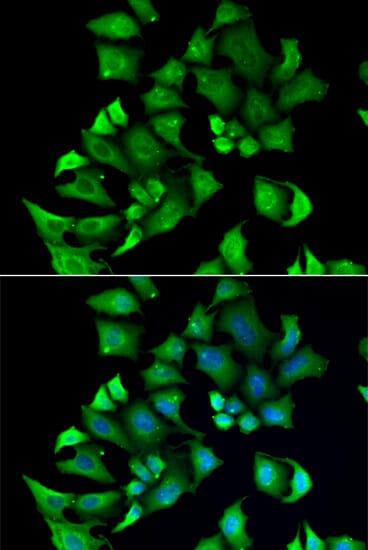 Immunofluorescence analysis of A549 cell using ENTPD2 antibody. Blue: DAPI for nuclear staining.