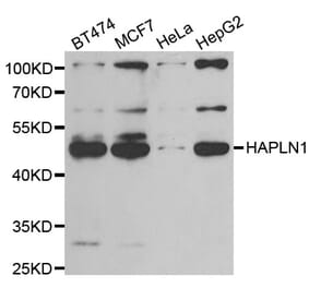 Western blot - HAPLN1 antibody from Signalway Antibody (39048) - Antibodies.com