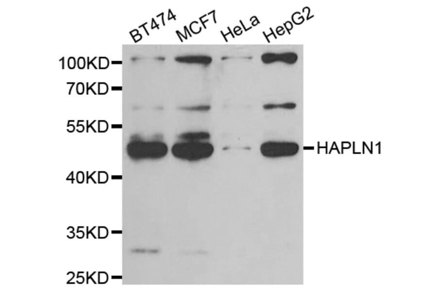 Western blot - HAPLN1 antibody from Signalway Antibody (39048) - Antibodies.com