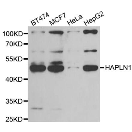 Western blot - HAPLN1 antibody from Signalway Antibody (39048) - Antibodies.com
