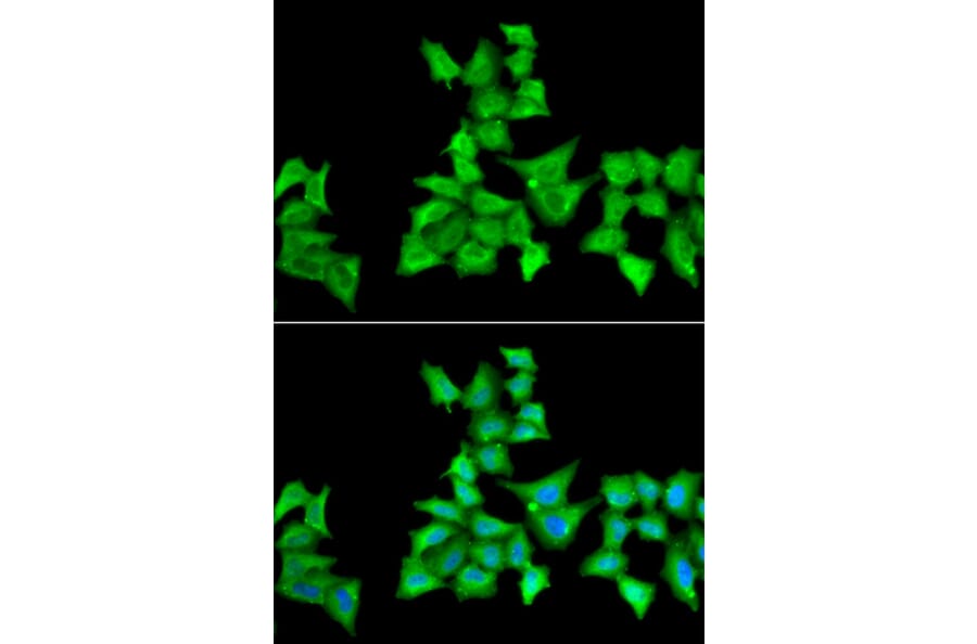 Immunofluorescence - HAPLN1 antibody from Signalway Antibody (39048) - Antibodies.com