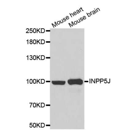 Western blot - INPP5J antibody from Signalway Antibody (39057) - Antibodies.com