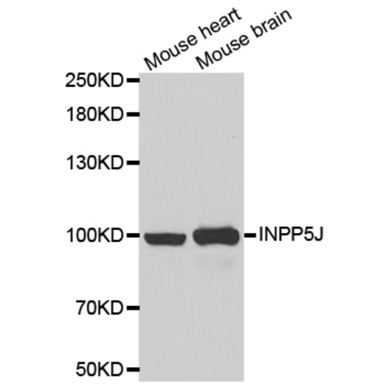 Western blot - INPP5J antibody from Signalway Antibody (39057) - Antibodies.com