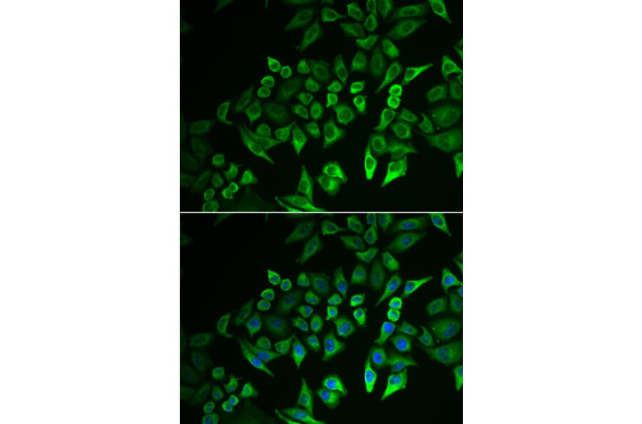 Immunofluorescence - INPP5J antibody from Signalway Antibody (39057) - Antibodies.com