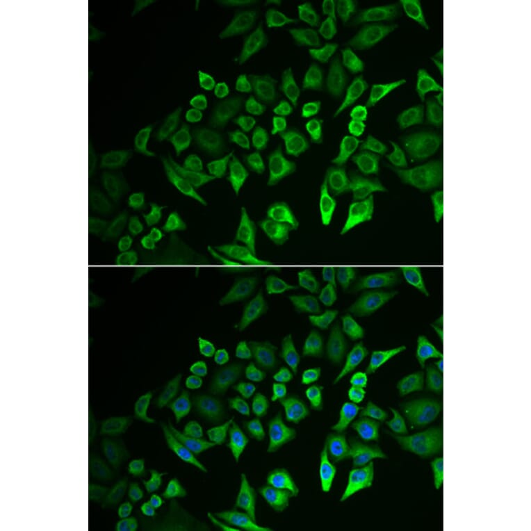 Immunofluorescence - INPP5J antibody from Signalway Antibody (39057) - Antibodies.com