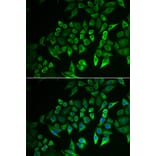 Immunofluorescence - INPP5J antibody from Signalway Antibody (39057) - Antibodies.com