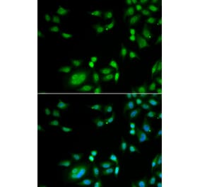 Immunofluorescence - INTS10 antibody from Signalway Antibody (39058) - Antibodies.com