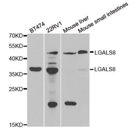 Western blot - LGALS8 antibody from Signalway Antibody (39068) - Antibodies.com