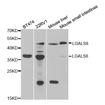 Western blot - LGALS8 antibody from Signalway Antibody (39068) - Antibodies.com