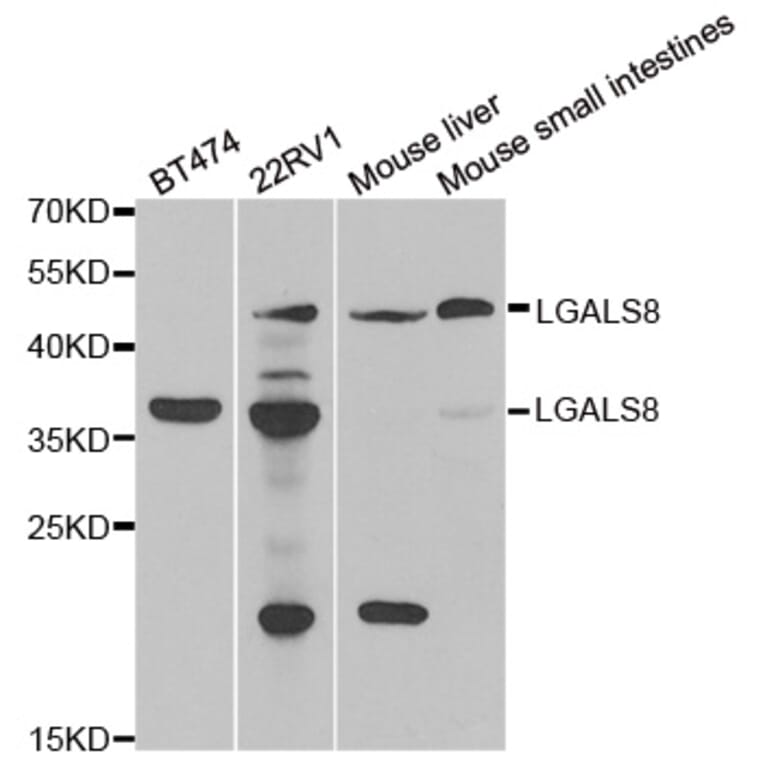 Western blot - LGALS8 antibody from Signalway Antibody (39068) - Antibodies.com