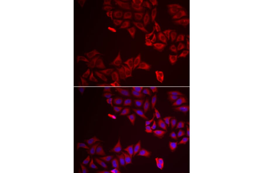 Immunofluorescence - LGALS8 antibody from Signalway Antibody (39068) - Antibodies.com